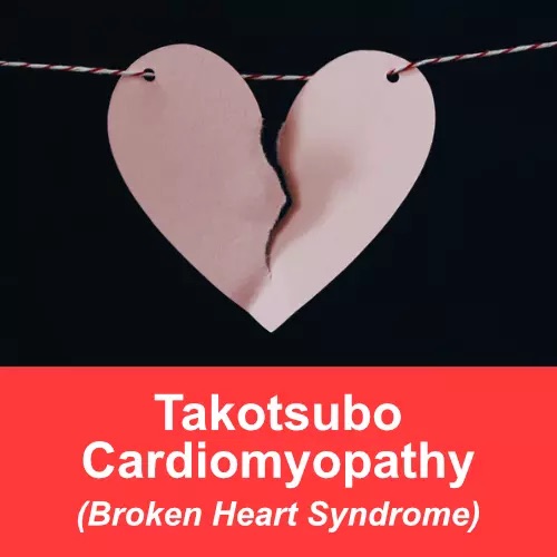 Thumbnail for Takotsubo Cardiomyopathy.
