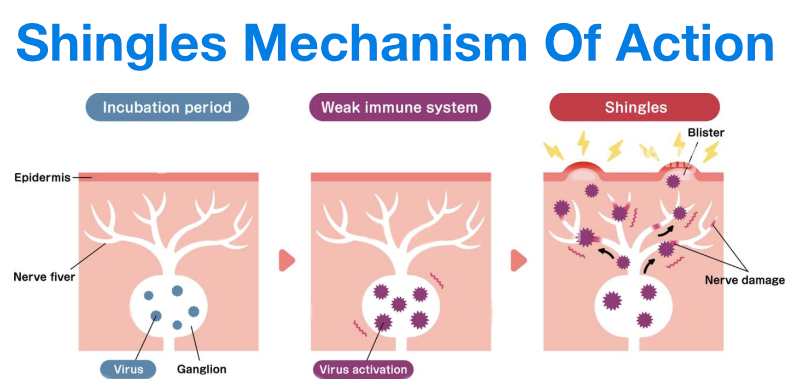 Stress and adrenal support illustration from the original shingles article.