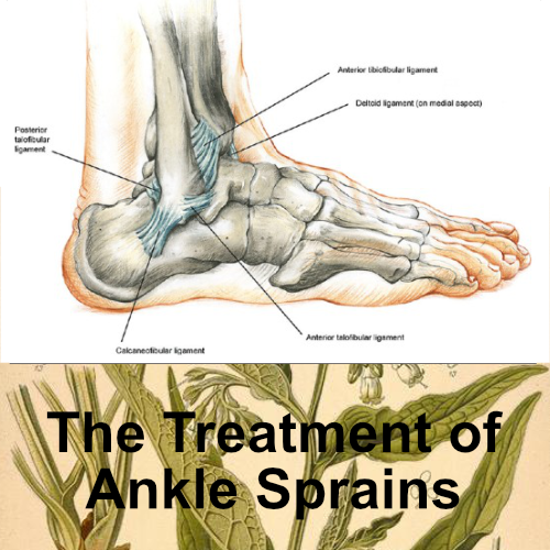 medical presentations: the treatment of ankle sprains