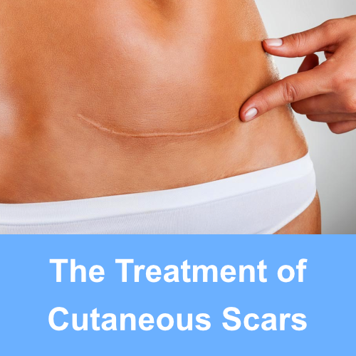 medical presentations: the treatment of cutaneous scars