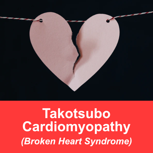 takotsubo cardiomyopathy (broken heart syndrome)